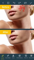 Screenshot 2 of Photo Retouch-Object Removal Hack